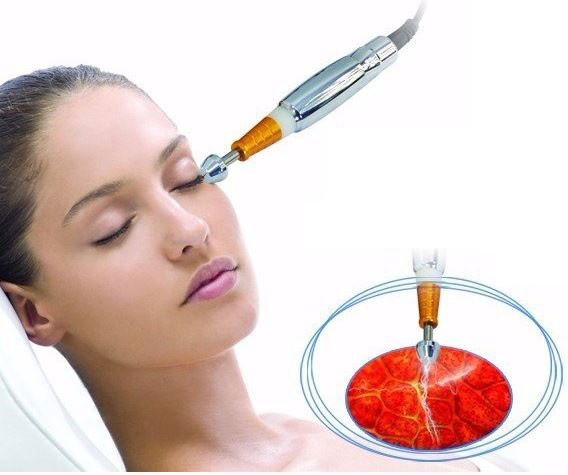 Tűnélküli Mezoterápiás Anti-aging
